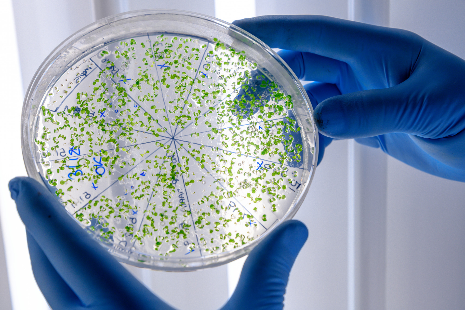 A scientist holds a petri dish scattered with green bacteria.
